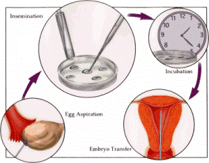 ivf-treatment-cycle